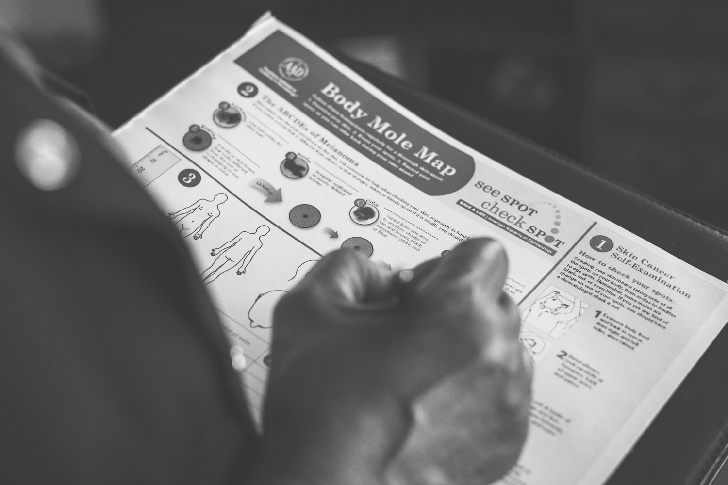 charting-during-skin-evaluation-in-phoenix-az-by-mobile-skin-screening-for-home-treatment