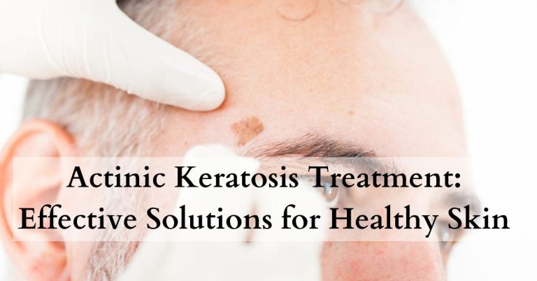 Actinic Keratosis vs Seborrheic Keratosis