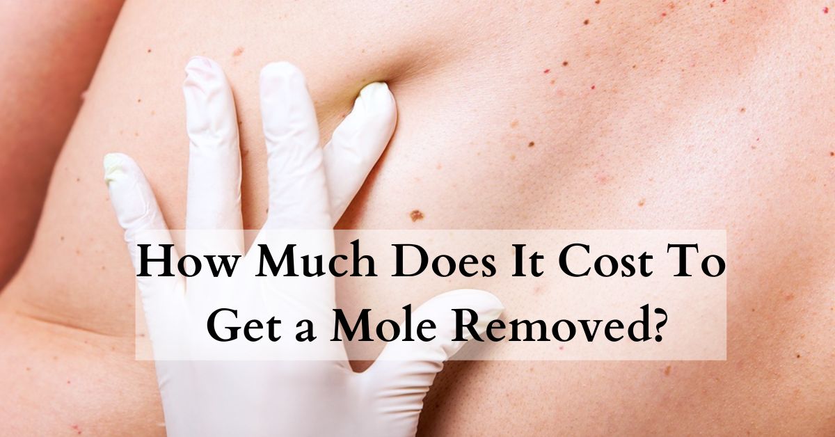 How Much Does It Cost To Get a Mole Removed?