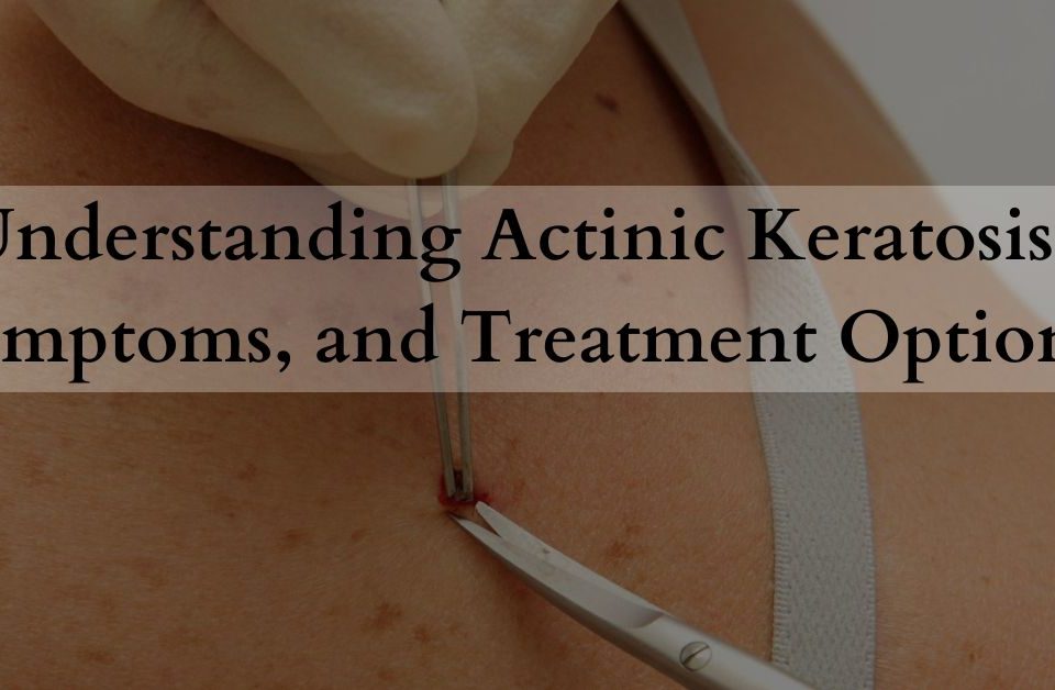 Understanding Actinic Keratosis Symptoms, and Treatment Options
