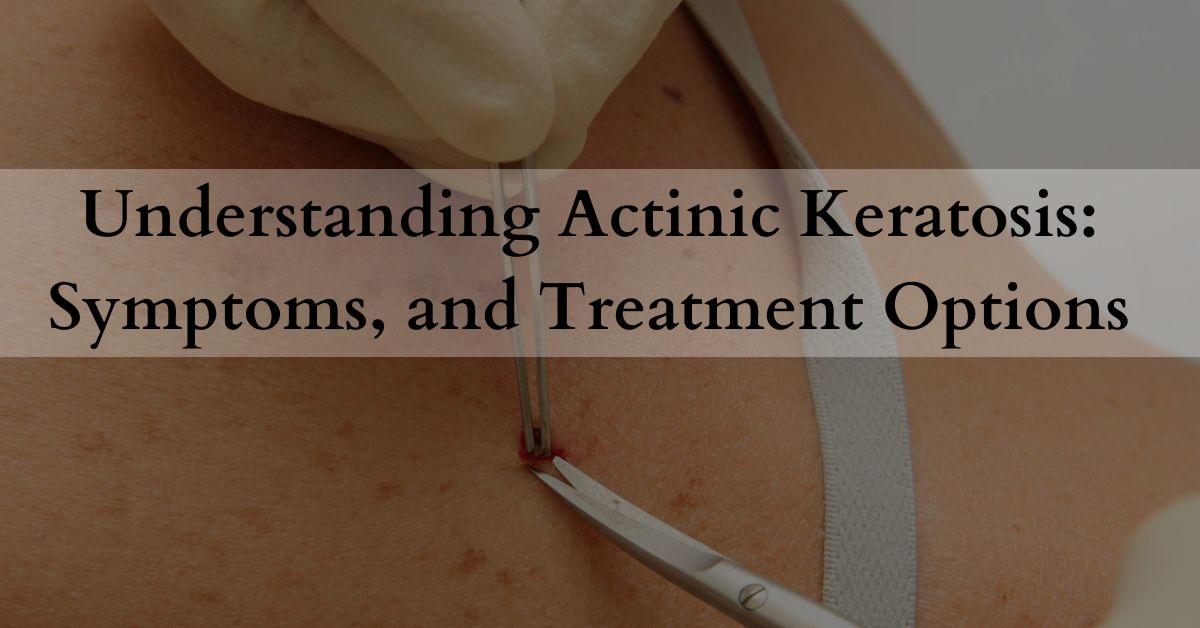 Understanding Actinic Keratosis Symptoms, and Treatment Options