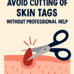 Why You Should Avoid Cutting Off Skin Tags Without Professional Help